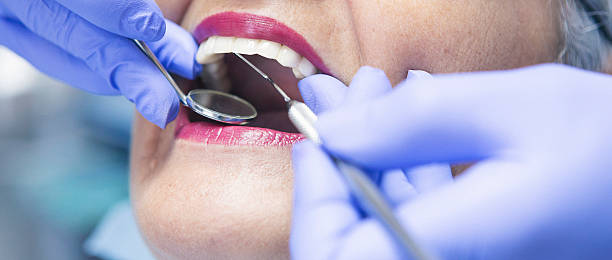Best Root Canal Emergency Dentist  in Beloit, KS